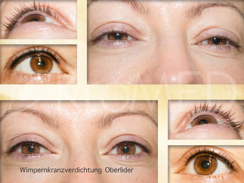 Augen Permanent Make Up Kromed Medizinisch Und Asthetische Micro Pigmentierung In Hamburg
